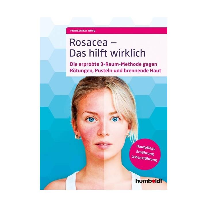 Rosacea - Das hilft wirklich